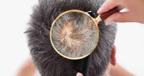 saç analizi nasıl yapılır