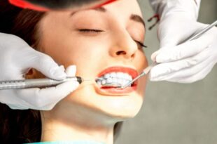 Düğün Öncesi Mükemmel Bir Gülüş İçin Diş Temizliğini İhmal Etmeyin!